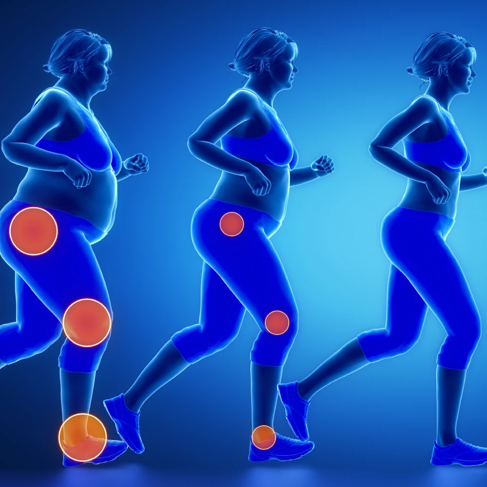 Aşırı Kilonun Eklem Sağlığı Üzerindeki Etkileri